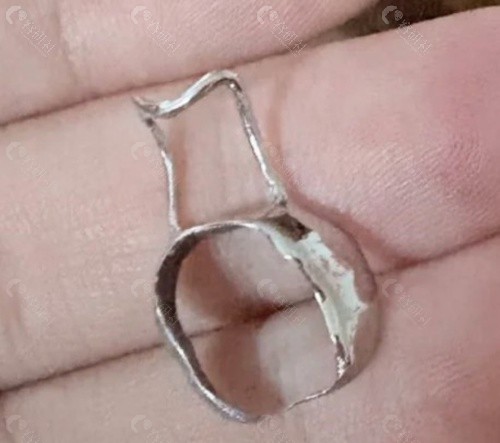 一副间隙保持器到底多少钱？
