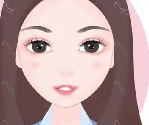 王博谦医生:仿生双眼皮技术特色与审美优势 王博谦医生:仿生双眼皮技术特色与审美优势