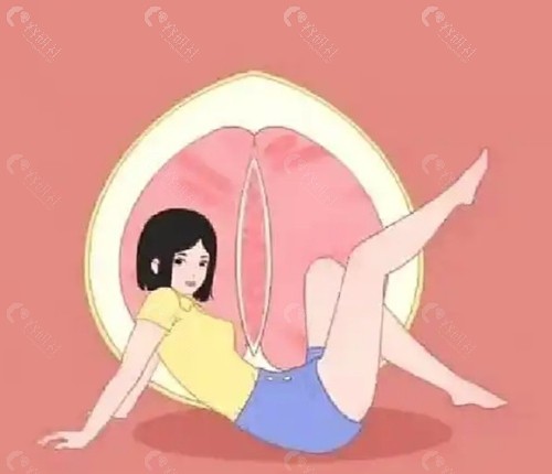 什么是“后方膣圆盖术”?它与传统缩阴有何不同? 什么是“后方膣圆盖术”?它与传统缩阴有何不同?