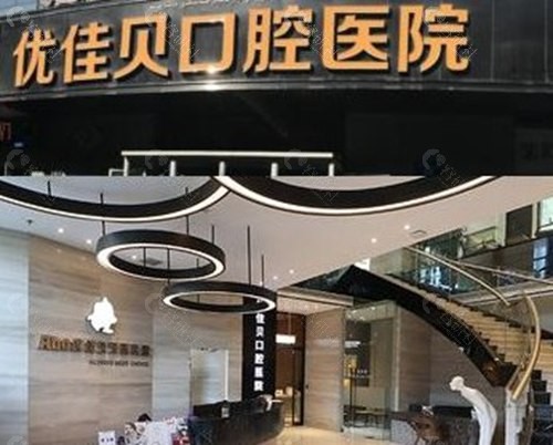 乌鲁木齐优佳贝口腔补牙收费贵吗? 乌鲁木齐优佳贝口腔补牙收费贵吗?