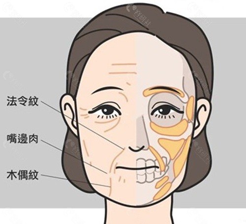 中家医黄广香拉皮手术怎么样? 中家医黄广香拉皮手术怎么样?