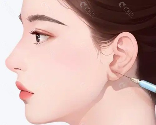 郑在皓院长解答：玻尿酸打耳朵，韩国常用什么牌子？