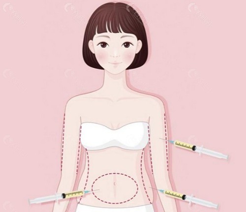 技术特色:从“单纯减脂”到“Swan艺术体雕”的升维 技术特色:从“单纯减脂”到“Swan艺术体雕”的升维