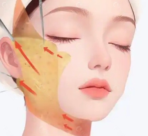 李晓东PST提升 李晓东PST提升